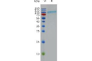 SDS-PAGE (SDS) image for Ectonucleoside Triphosphate diphosphohydrolase 1 (ENTPD1) (AA 40-476) protein (Fc Tag) (ABIN6964138)