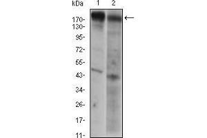 Western blot analysis using EGFR mouse mAb against A431 (1) AND Hela (2) cell lysate. (EGFR 抗体  (AA 693-893))