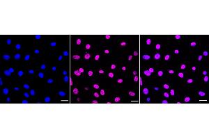 Immunocytochemical staining of C2C12 cells with Histone H2B (acetyl K20) antibody (ABIN7798944), 1:1,000). (Recombinant Histone H2B 抗体  (H2BK20ac))