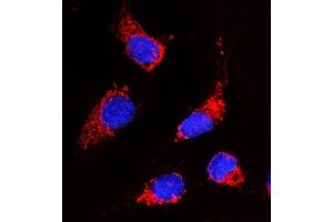 IF analysis of ACACA using anti-ACACA antibody (ABIN7601254).
