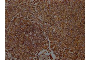IHC image of ABIN7156538 diluted at 1:100 and staining in paraffin-embedded Human spleen tissue performed on a Leica BondTM system. (ICAM-3/CD50 抗体  (AA 200-547))