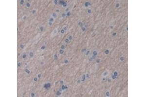 #VALUE! (LARGE 抗体  (AA 25-178))