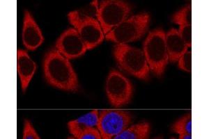 Confocal immunofluorescence analysis of HeLa cells using RPL36AL Polyclonal Antibody at dilution of 1:100. (RPL36AL 抗体)