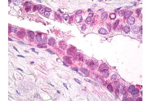 Immunohistochemistry (IHC) image for anti-Proteasome (Prosome, Macropain) 26S Subunit, Non-ATPase, 11 (PSMD11) (AA 288-317) antibody (ABIN1103824)