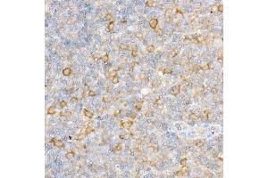 Immunohistochemistry of paraffin-embedded mouse kidney using RPGR Rabbit pAb (ABIN3015609, ABIN3015610, ABIN3015611, ABIN1682567 and ABIN6218971) at dilution of 1:50 (40x lens).
