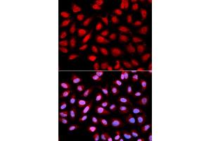 Immunofluorescence analysis of U2OS cells using PPP2R4 antibody. (PPP2R4 抗体)