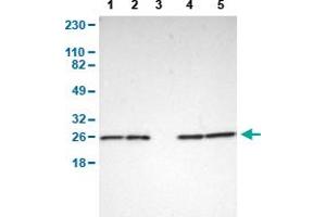 Western Blot analysis of (1) human cell line RT-4, (2) human cell line U-251MG sp, (3) human plasma (IgG/HSA depleted), (4) human liver tissue, and (5) human tonsil tissue. (PARK7/DJ1 抗体  (AA 40-177))