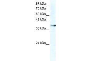 WB Suggested Anti-ZNF556 Antibody Titration:  2. (ZNF556 抗体  (C-Term))