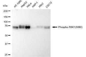 Western blotting analysis using Phospho-RSK1(S380) antibody (ABIN7800230). (Recombinant RPS6KA1 抗体  (pSer380))