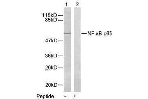 Image no. 2 for anti-Nuclear Factor-kB p65 (NFkBP65) (Ser276) antibody (ABIN197110) (NF-kB p65 抗体  (Ser276))