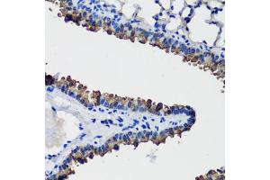Immunohistochemistry (IHC) image for anti-Secretoglobin, Family 1A, Member 1 (Uteroglobin) (SCGB1A1) (AA 22-91) antibody (ABIN7270184)