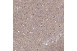 Immunohistochemical staining of human cerebral cortex shows weak positivity in neuropil. (CACNG4 抗体)