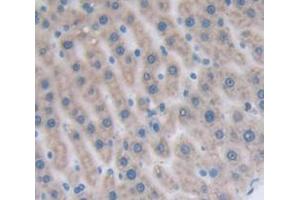 IHC-P analysis of Rat Tissue, with DAB staining. (CCL22 抗体  (AA 27-92))