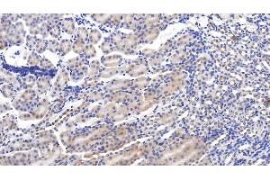 Detection of C1INH in Mouse Kidney Tissue using Polyclonal Antibody to Complement 1 Inhibitor (C1INH) (SERPING1 抗体  (AA 397-495))