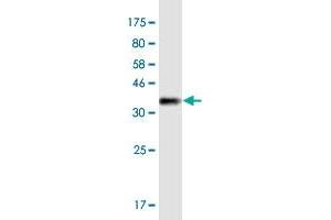 Western Blot detection against Immunogen (36. (MYO1E 抗体  (AA 918-1014))