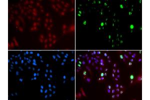 Immunofluorescence analysis of GFP-RNF168 transgenic U2OS cell using FANCD2 antibody. (FANCD2 抗体  (AA 1-230))