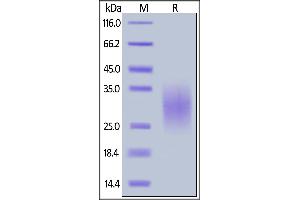 Mouse TRAIL R2, His Tag on  under reducing (R) condition. (TNFRSF10B Protein (AA 53-180) (His tag))