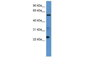 WB Suggested Anti-CPNE9 Antibody Titration: 0. (CPNE9 抗体  (C-Term))