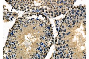 ABIN6264007 and ABIN6277984 at 1/100 staining Mouse testis tissue by IHC-P. (Poly(A) Binding Protein, Cytoplasmic, Pseudogene 2 (PABPCP2) (C-Term) 抗体)