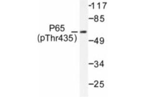 Image no. 1 for anti-Nuclear Factor-kB p65 (NFkBP65) (pThr435) antibody (ABIN318087) (NF-kB p65 抗体  (pThr435))