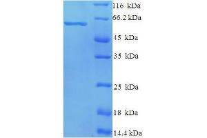 SDS-PAGE (SDS) image for NCAP (AA 1-391), (full length) protein (His-SUMO Tag) (ABIN5710922) (NCAP (AA 1-391), (full length) protein (His-SUMO Tag))