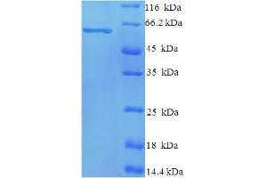 SDS-PAGE (SDS) image for NCAP (AA 1-391), (full length) protein (His-SUMO Tag) (ABIN5710922) (NCAP (AA 1-391), (full length) protein (His-SUMO Tag))