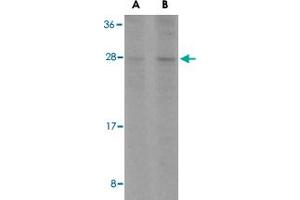 Western blot analysis of BCL2L1 in A-549 cell lysates with BCL2L1 polyclonal antibody  at (A) 1 and (B) 2 ug/mL . (BCL2L1 抗体  (C-Term))