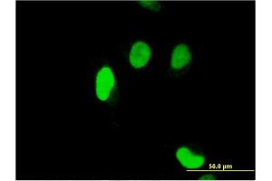 Immunofluorescence of monoclonal antibody to SERTAD1 on HeLa cell. (SERTAD1 抗体  (AA 1-236))