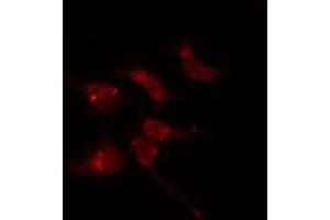 ABIN6274100 staining 293T by IF/ICC. (PHF1 抗体  (Internal Region))