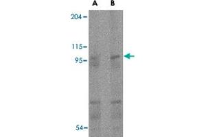 Western blot analysis of TMC6 in human spleen tissue lysate with TMC6 polyclonal antibody  at (A) 1 and (B) 2 ug/mL . (TMC6 抗体  (Internal Region))