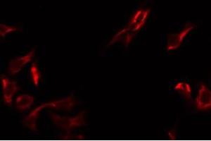 ABIN6275063 staining HT29 by IF/ICC. (DMGDH 抗体  (C-Term))