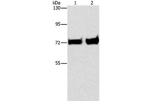 Western Blot analysis of Mouse liver and kidney tissue using PCK1 Polyclonal Antibody at dilution of 1:375 (PCK1 抗体)