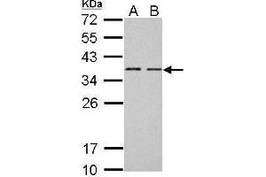WB Image BCL7A antibody [C2C3], C-term detects BCL7A protein by Western blot analysis. (BCL7A 抗体  (C-Term))