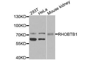 Western blot analysis of extracts of various cell lines, using RHOBTB1 antibody (ABIN6003667) at 1/1000 dilution. (RHOBTB1 抗体)