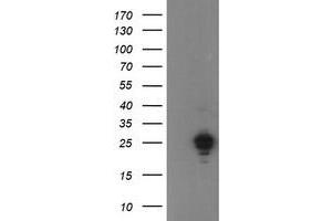 Image no. 1 for anti-Ubiquitin-Conjugating Enzyme E2E 3 (UBE2E3) antibody (ABIN1501621) (UBE2E3 抗体)