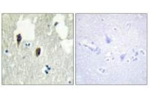 Immunohistochemistry analysis of paraffin-embedded human brain tissue, using KLHL3 antibody. (KLHL3 抗体  (N-Term))