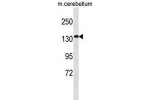 Western Blotting (WB) image for anti-Calmodulin Regulated Spectrin-Associated Protein Family, Member 3 (CAMSAP3) antibody (ABIN3000129) (CAMSAP3 抗体)