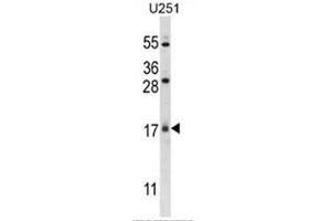 C1orf144 Antibody (N-term) western blot analysis in U251 cell line lysates (35µg/lane). (C1orf144 抗体  (N-Term))