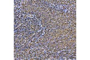 IHC analysis of MAT2A using anti-MAT2A antibody (ABIN7599120).