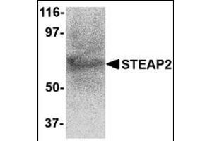 Western blot analysis of STEAP2 in human prostate tissue lysate with this product at 1 μg/ml. (STEAP2 抗体  (C-Term))
