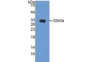 Detection of Recombinant SIRT5, Mouse using Polyclonal Antibody to Sirtuin 5 (SIRT5) (SIRT5 抗体  (AA 37-310))