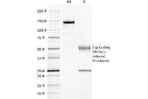 SDS-PAGE Analysis Purified GNAQ Mouse Monoclonal Antibody (GNAQ/2434). (GNAQ 抗体)