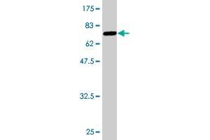 Western Blot detection against Immunogen (64. (SORD 抗体  (AA 1-357))