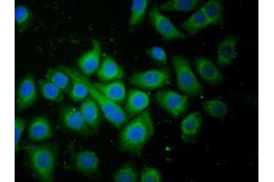 Detection of FAM3C in Human HepG2 cell using Polyclonal Antibody to Family With Sequence Similarity 3, Member C (FAM3C) (FAM3C 抗体  (AA 25-227))