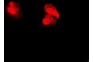 Immunofluorescent analysis of PSMA5 staining in U2OS cells. (PSMA5 抗体)