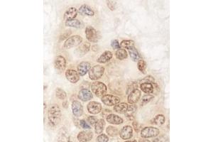 Immunohistochemistry (IHC) image for anti-Glutamine and serine Rich 1 (QSER1) (AA 175-225) antibody (ABIN7453768) (QSER1 抗体  (AA 175-225))