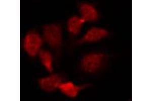 ABIN6274601 staining HepG2 by IF/ICC. (CDH22 抗体  (N-Term))