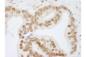 Immunohistochemistry (IHC) image for anti-Non-POU Domain Containing, Octamer-Binding (NONO) (AA 350-400) antibody (ABIN7448694)
