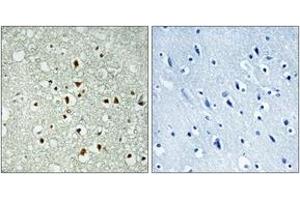 Immunohistochemistry analysis of paraffin-embedded human brain tissue, using MAX (Ab-2) Antibody. (MAX 抗体  (AA 1-50))