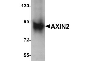 Western Blotting (WB) image for anti-Axin 2 (AXIN2) (C-Term) antibody (ABIN1030274) (AXIN2 抗体  (C-Term))